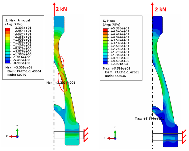 Figure 4 - Results of the static FE simulations a) max principal stress, b) Von Mises stress